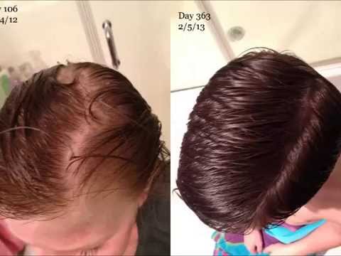 castor oil to regrow hair